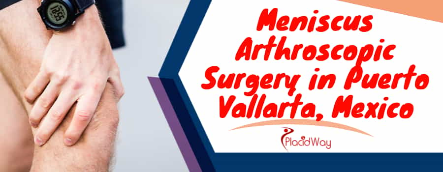 Meniscus Arthroscopic Surgery in Puerto Vallarta, Mexico